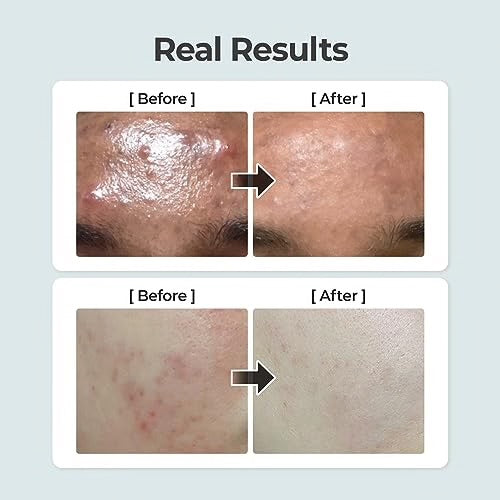 No. 4 Pore Zero Peeled Egg Toner
Pad- Numbuzin