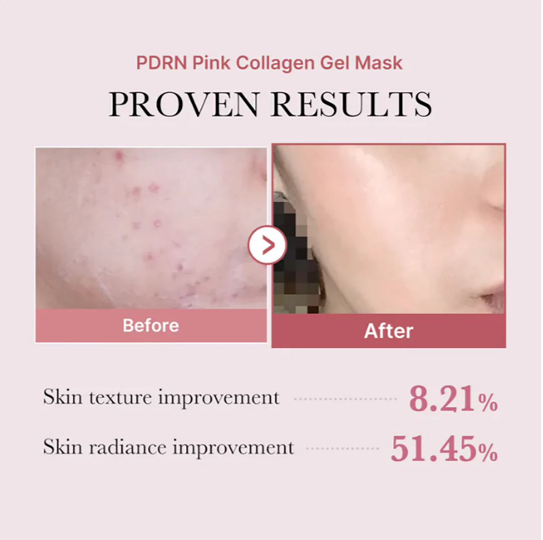 MEDICUBE Pink PDRN Jelly Collagen Gel Mask
