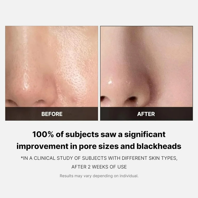 Medicube Zero Pore Pad 2.0 70 pads