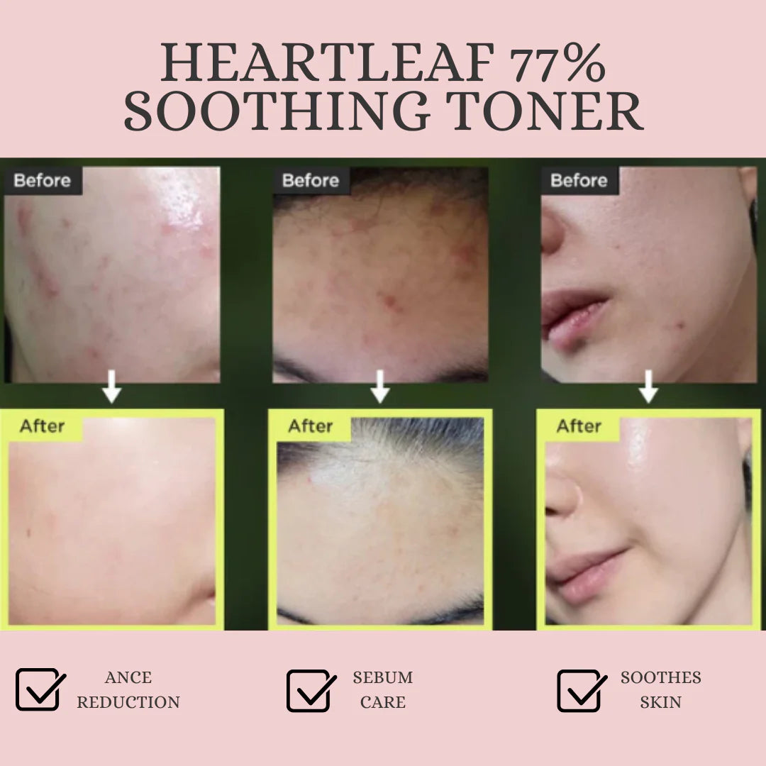 Anua Heartleaf 77% Soothing Toner Mini