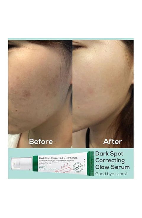 [AXIS-Y]Dark Spot Correcting Glow Serum Mini