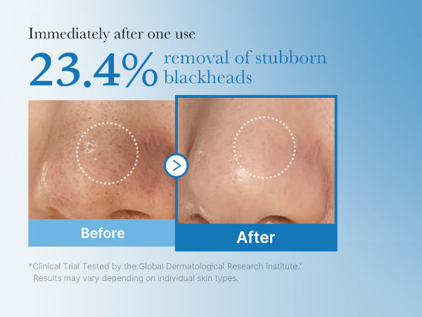 [medicube] Aceite Limpiador Zero Pore Blackhead Deep Cleansing Oil