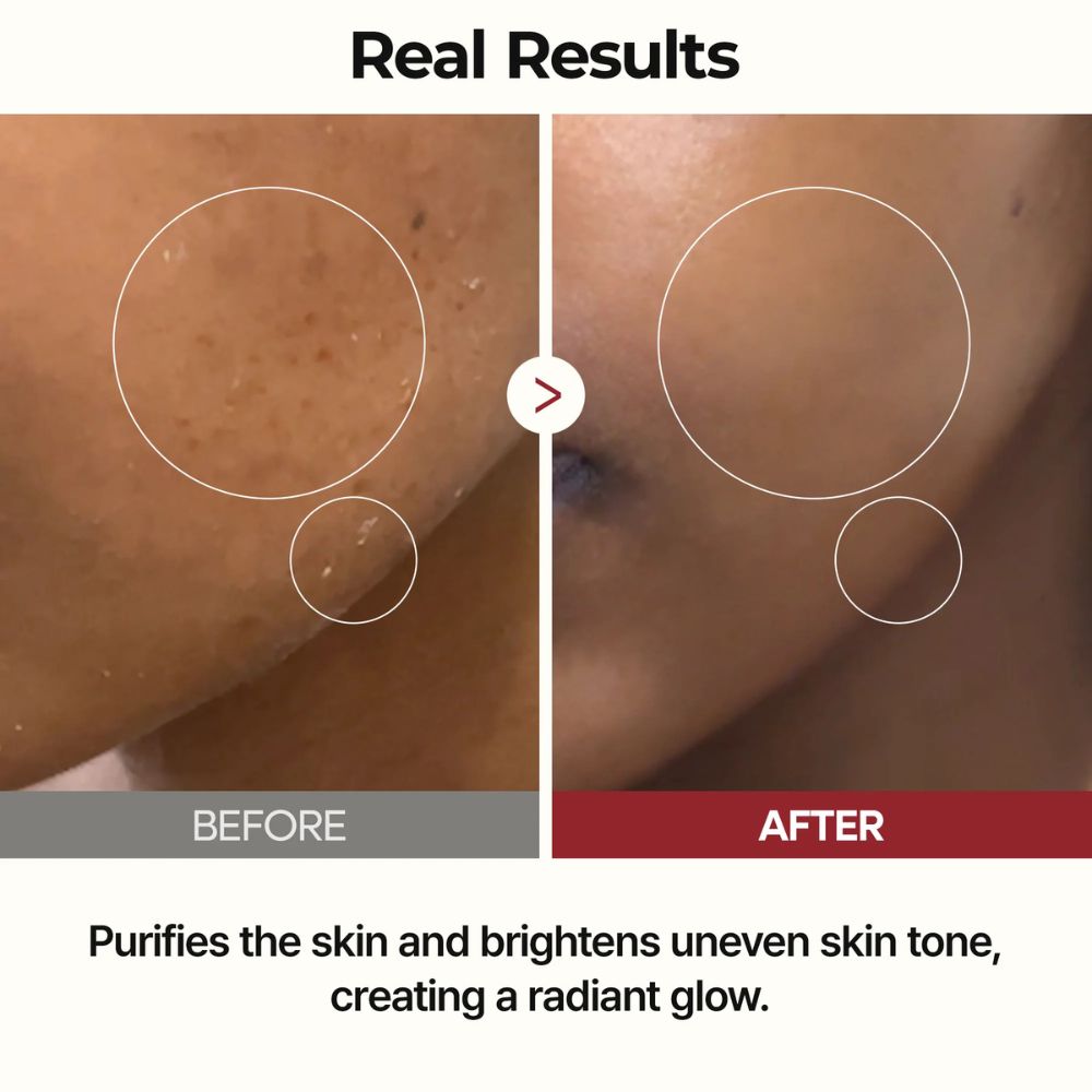 [Dr. Melaxin] Peel Shot Glow Rice Toner 200ml