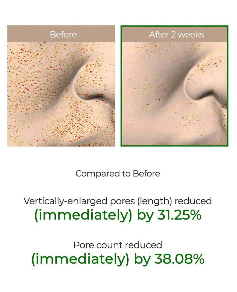 VtCosmetics- Reedle Shot 100