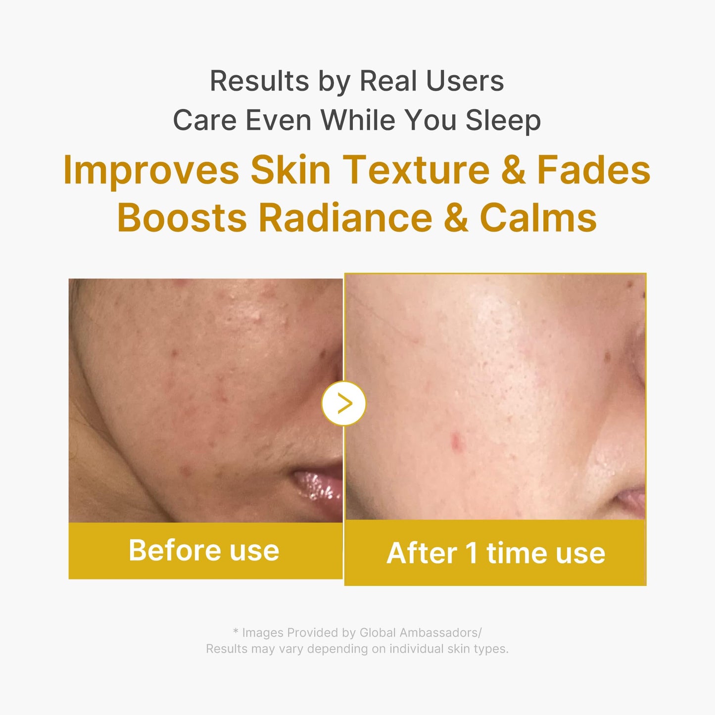 [Medicube] 4EA Kojic Turmeric Gel Mask