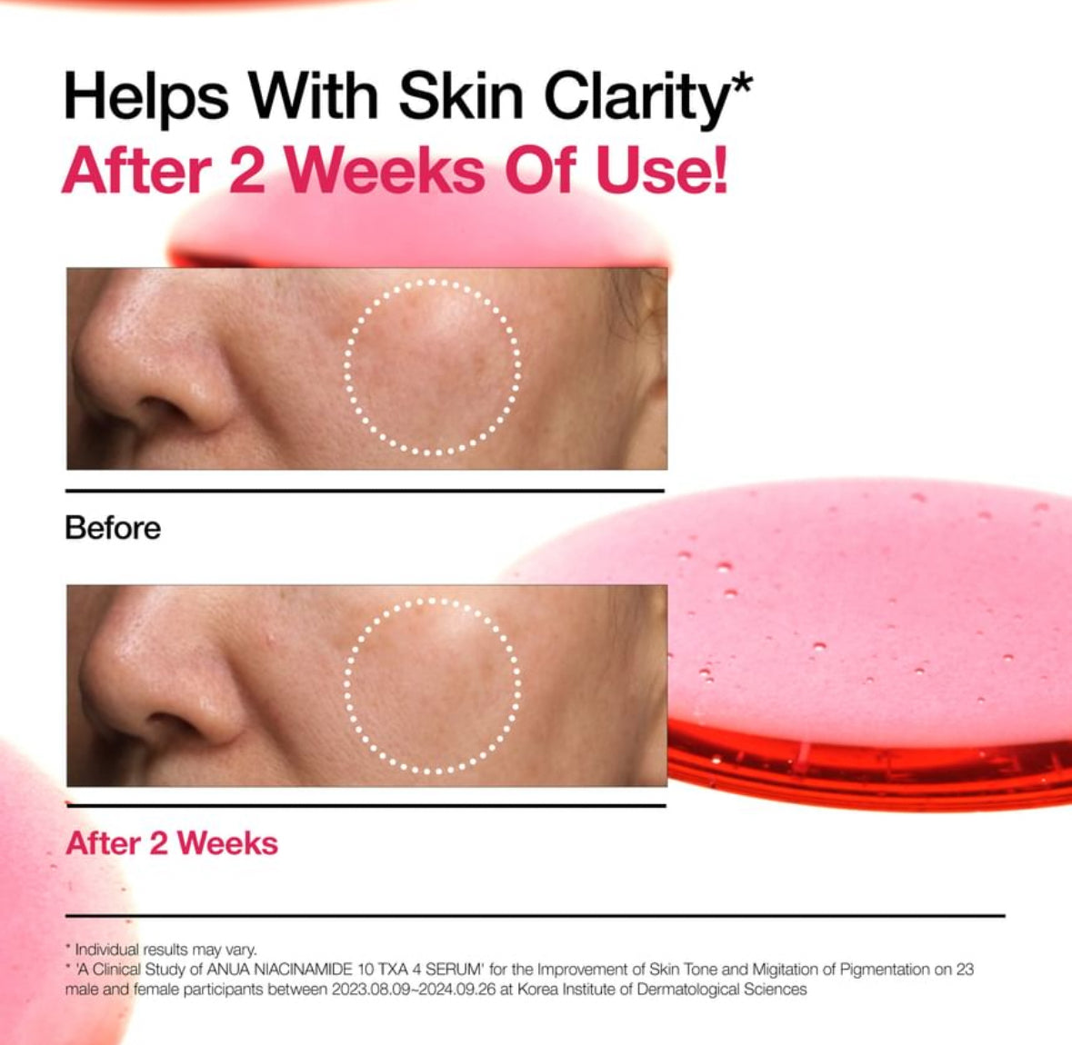 [Anua] Brightening Boost Serum Duo Set 2 pcs