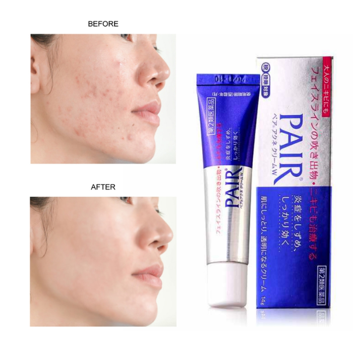 [LION] - Crema para el Acné Pair Acne Cream W