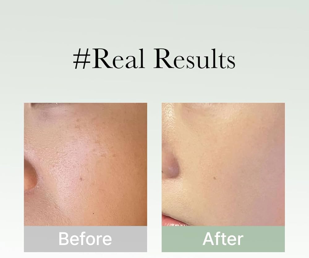 [ARENCIA] Holy Hyssop Serum 30 50g