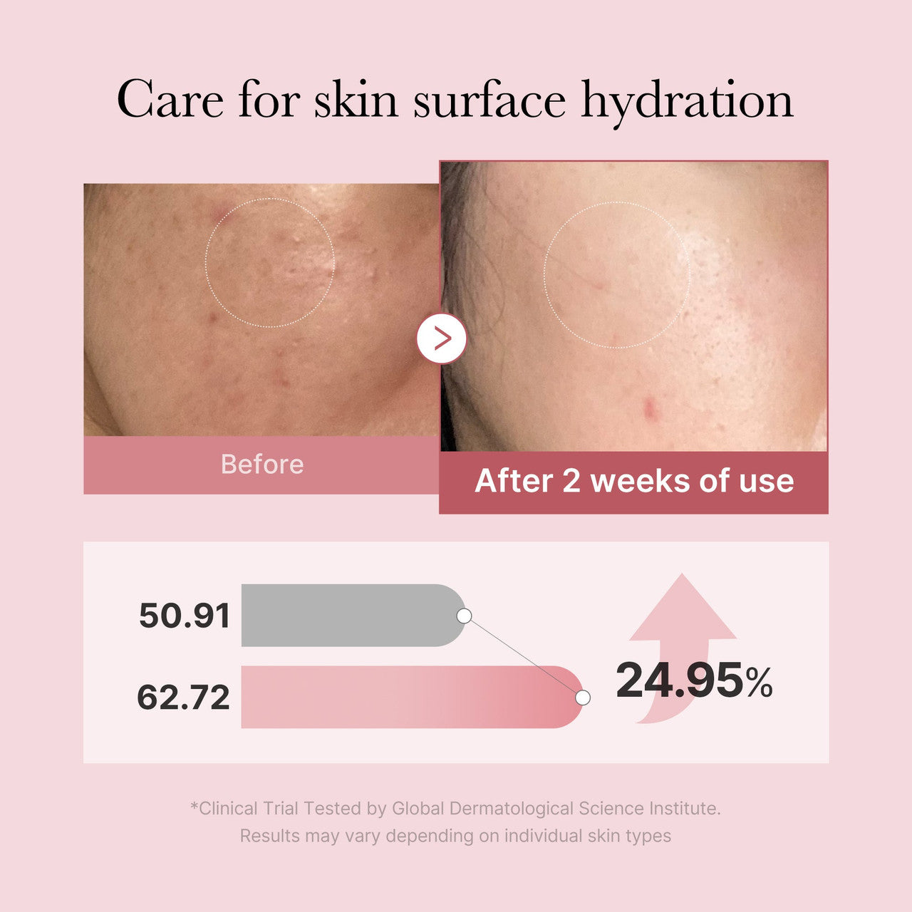 [MEDICUBE] PDRN Pink Glutathione Serum Mist 100ml