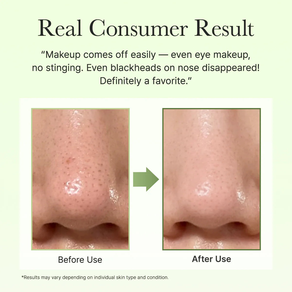[Arencia] Pore Melt Phyto PDRN