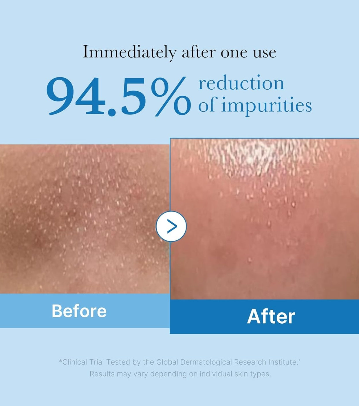 [medicube] Aceite Limpiador Zero Pore Blackhead Deep Cleansing Oil