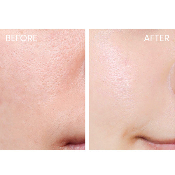 Keana Rice Mask 10pcs