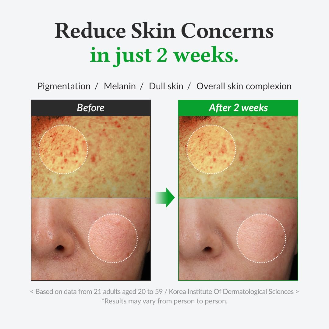 [Dr. Althea] Gentle Vitamin C Serum