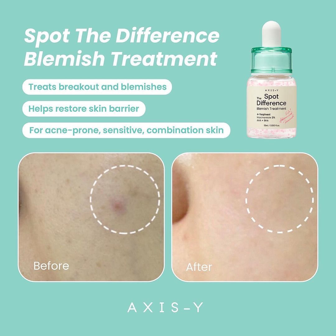Axis-Y The Spot Difference Blemish Treatment