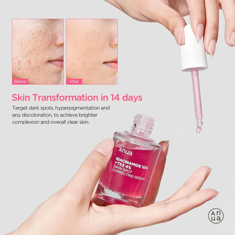 [Anua] Niacinamide 10% + TXA 4% Dark Spot Correcting Serum 30ml