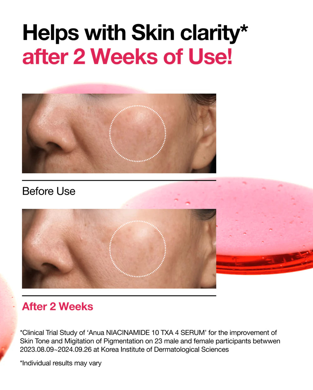 Anua- Niacinamide 10 TXA 4 Serum 2025 Version