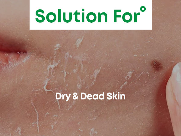 [NINE LESS] A-Control 10% Azelaic Acid Serum