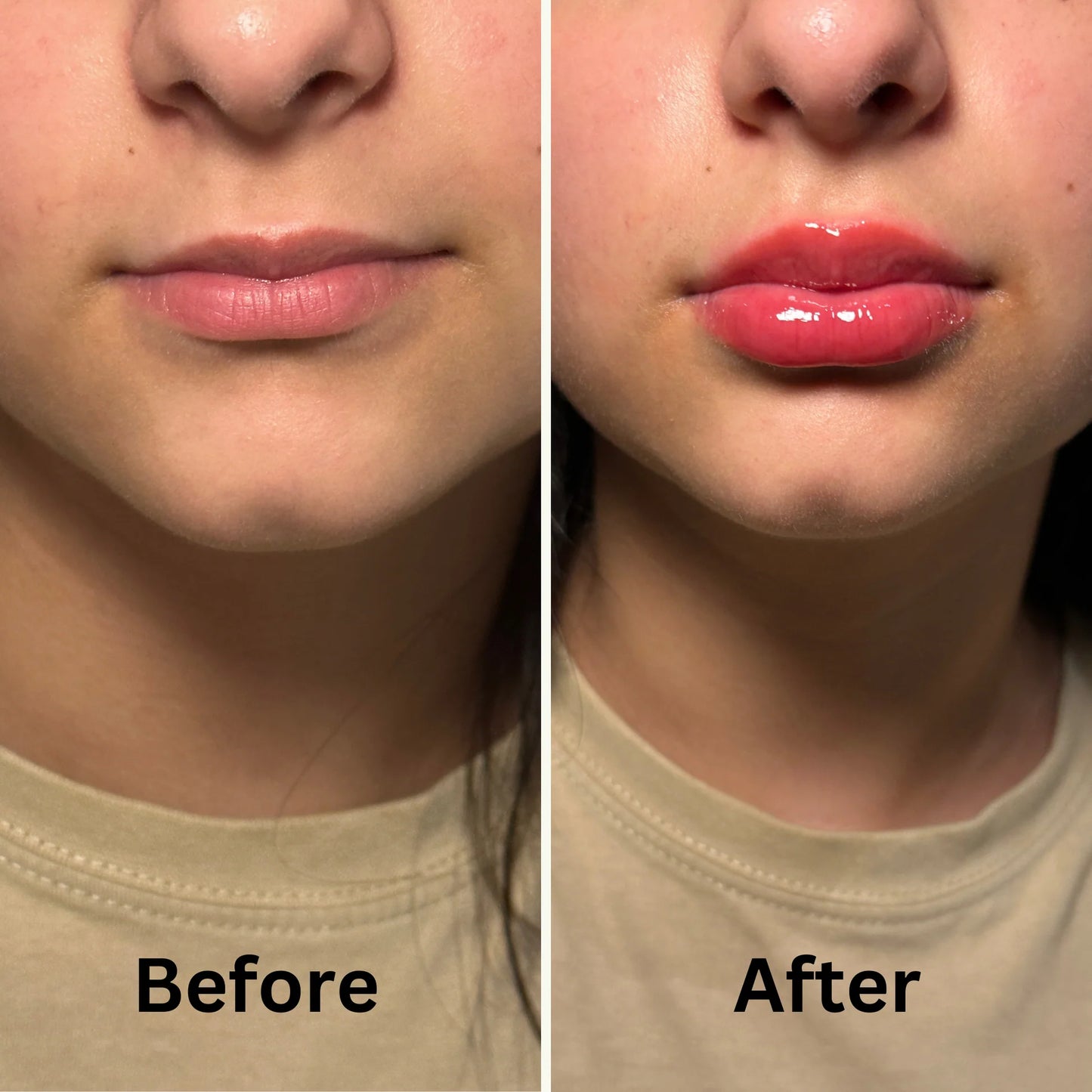 [VT cosmetics] Reedle Shot Lip Plumper Expert