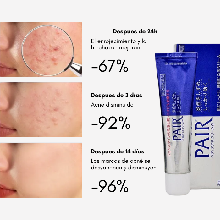 [LION] - Crema para el Acné Pair Acne Cream W
