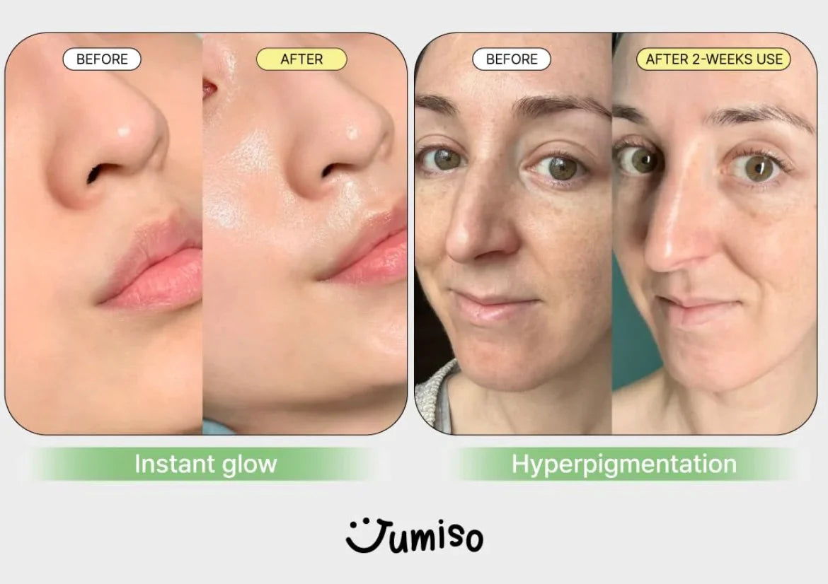 [Jumiso] All Day Pure C 5.5 Serum 15ml