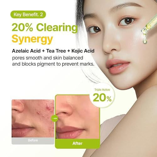 [purito] Azelaic 10 Kojic Azulene Serum 30ml
